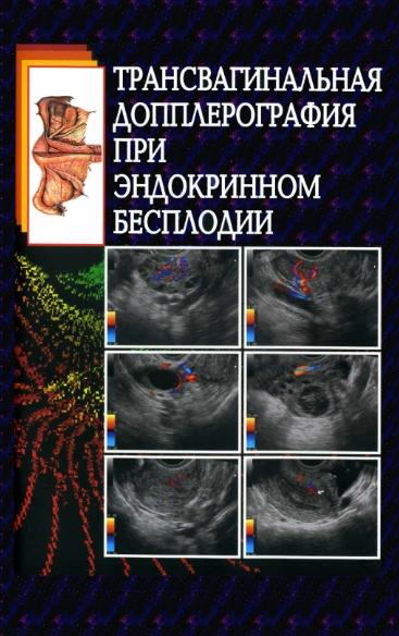 Р.Я. Абдуллаев. Трансвагинальная допплерография при эндокринном бесплодии